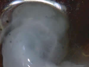 head